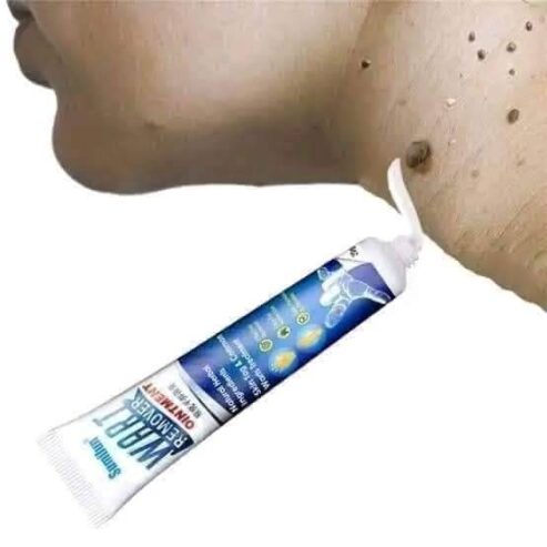 Wart Remover Ointment