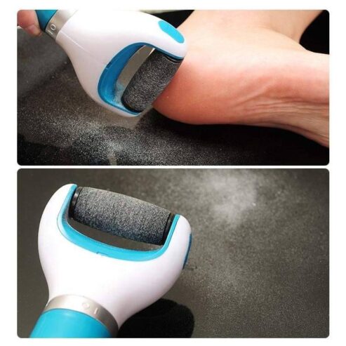 Cordless Electric Callus Remover